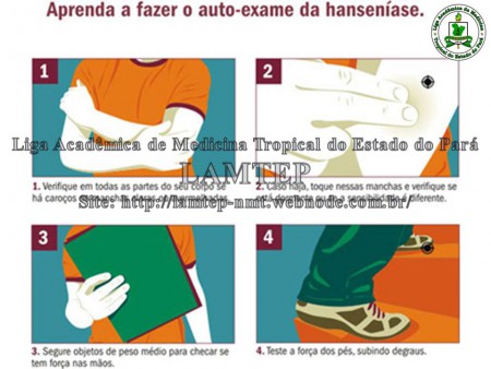 URE Marcello Candia - Avaliação de sensibilidade e incapacidade (24/07/2012)